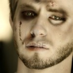 3688027-close-up-of-a-beaten-up-boy-with-blood-and-bruises