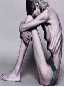 A-Z Photo Anorexia Nervosa
